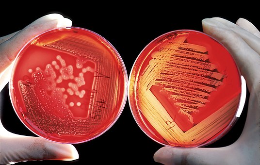 agar-60571__340